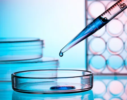 Trakta Control y Tratamientos Legionella Palmas de Gran Canaria – control de plagas en Las Palmas de Gran Canaria